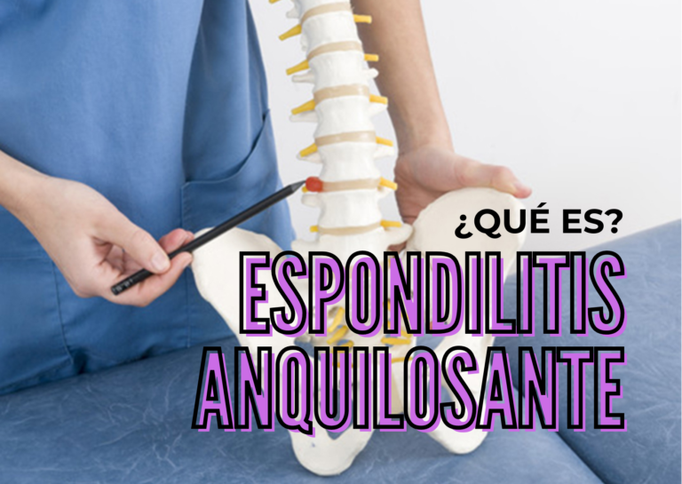 espondilitis anquilosante fisiosalud ciudad lineal